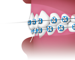 Flossing - Step 4